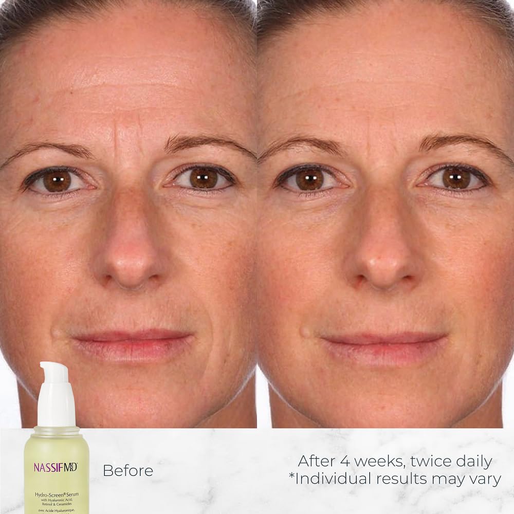 NassifMD Hydro-Screen - Clinical Grade Serum with Premium Ingredients: Ceramides, Retinol, Bakuchiol, Hyaluronic Acid - Anti Aging Treatment