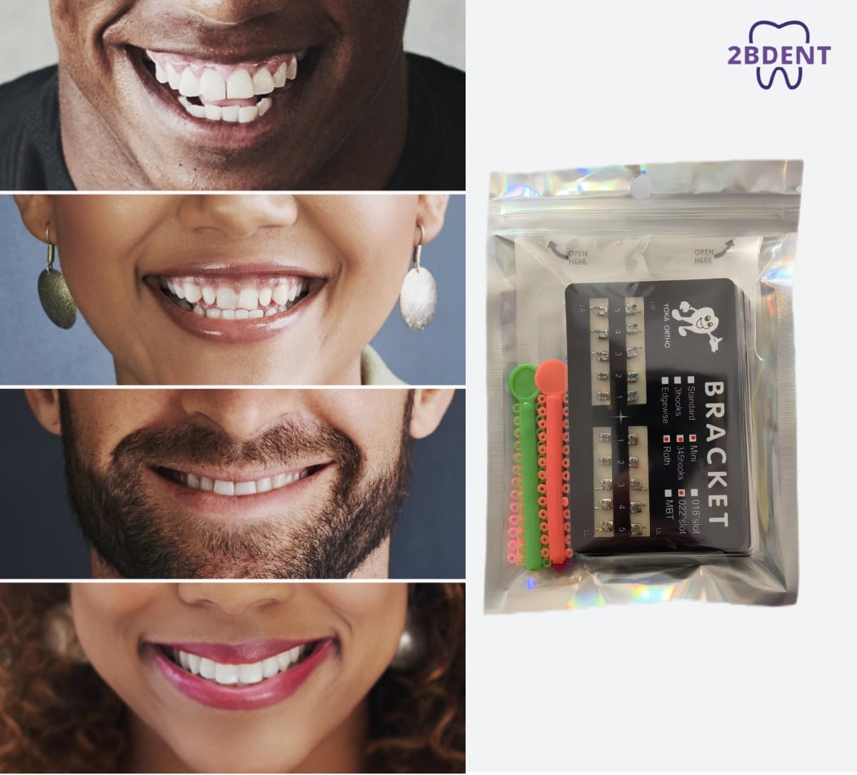 2BDENT Dental Braces Kit Orthodontic Metal Braces Kit, Orthodontic Ligature Ties Kit