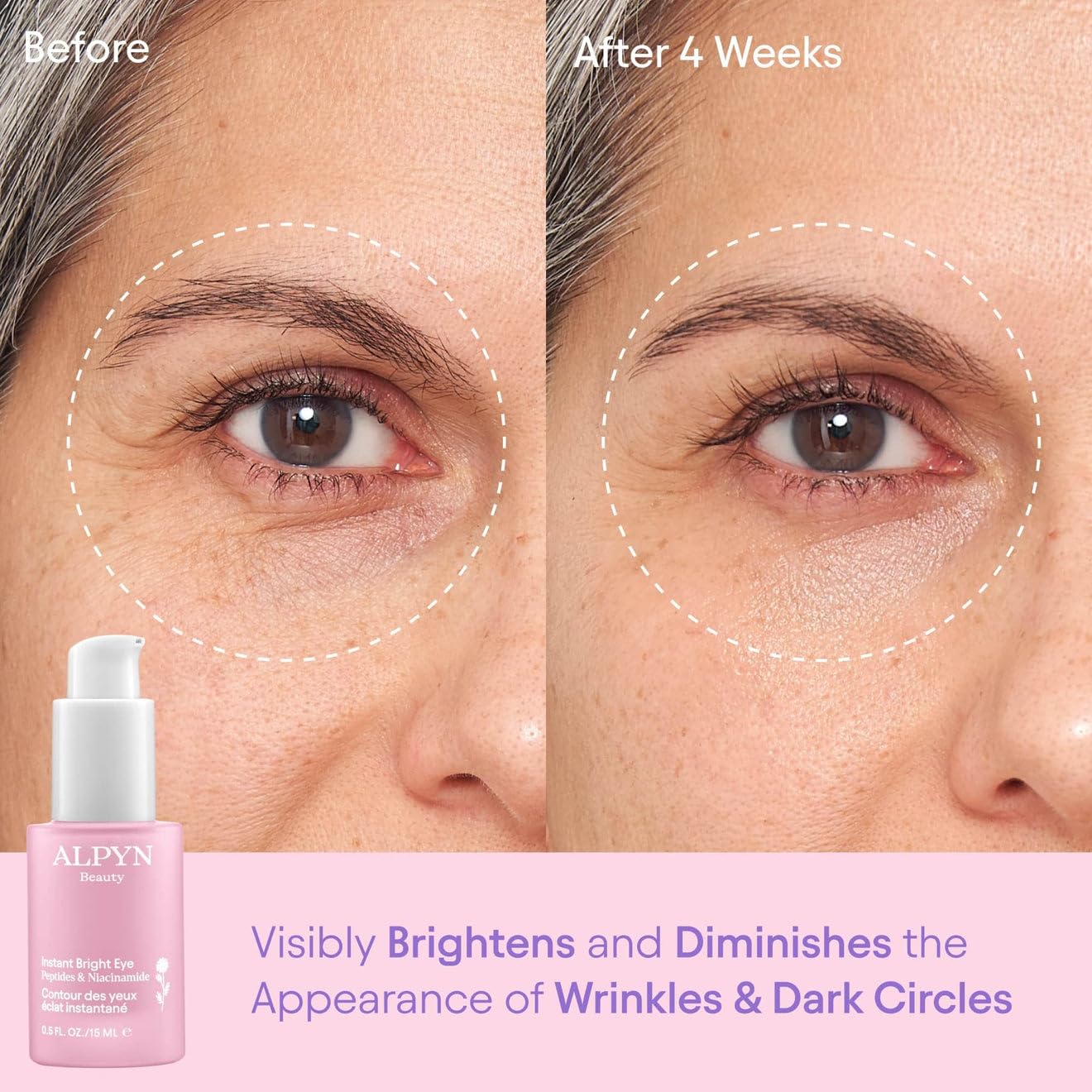 Alpyn Instant Bright Eye with Peptides & Niacinamide | Brightens Dark Circles, Visibly Firms & Softens Fine Lines | 0.5 Fl Oz / 15 ml