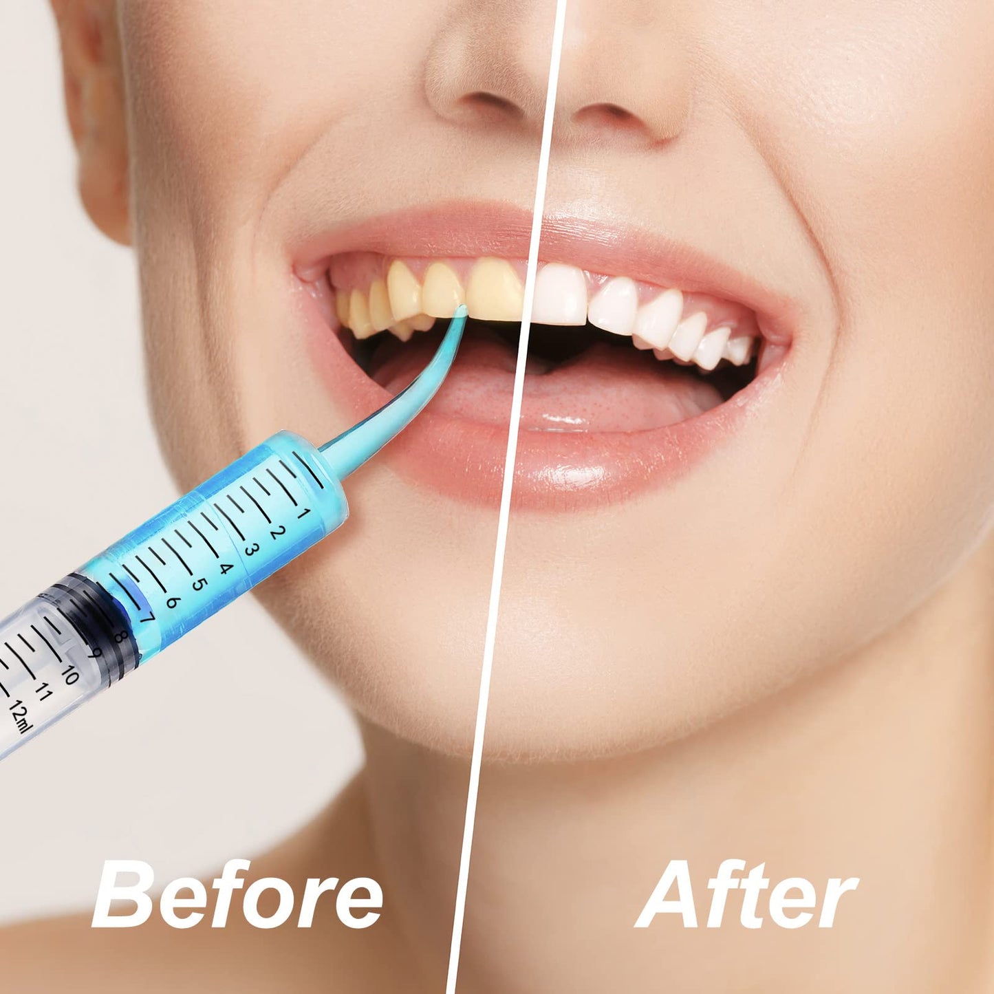 100 Pack Dental Syringe with Curved Tip 12ml Disposable Irrigation Dental Syringe for Tonsil Stones Squirt Liquid Injection Mouthwash Cleaner Oral Tooth Care