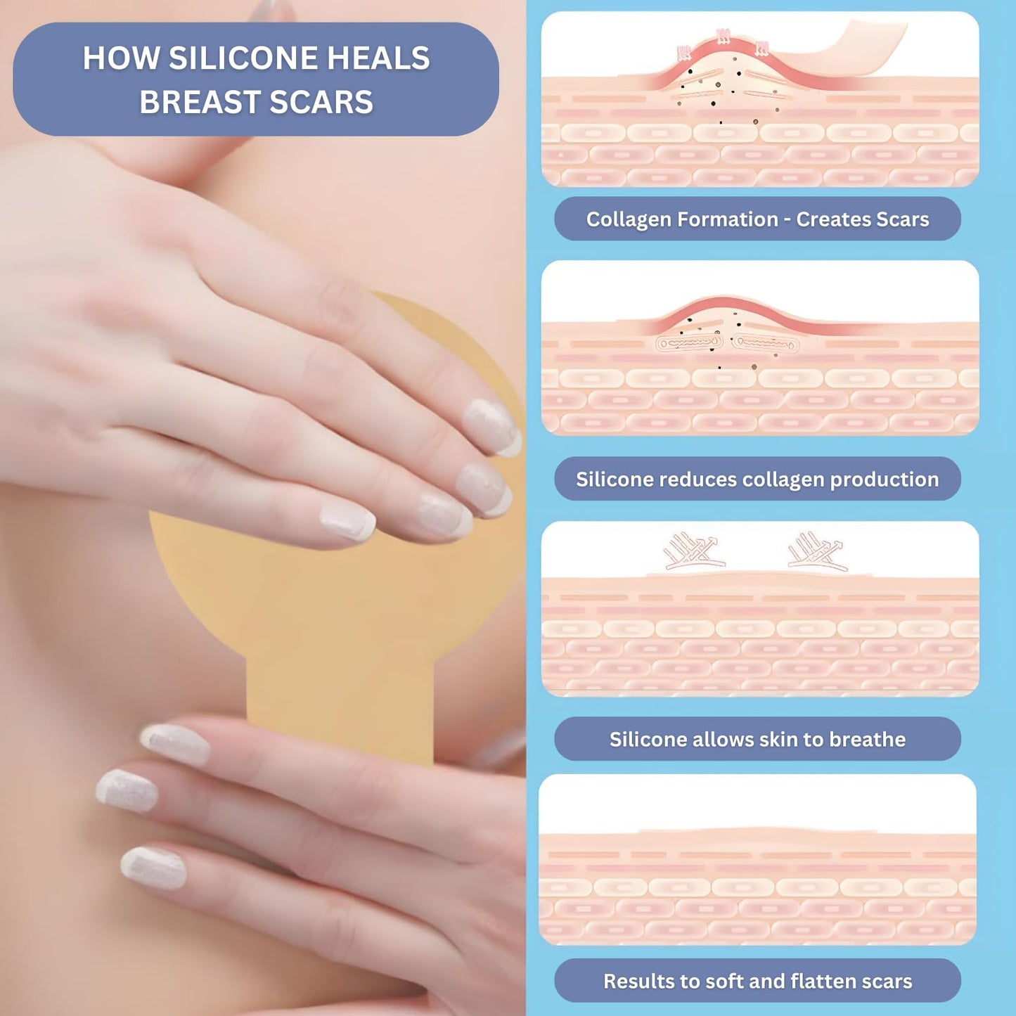 Breast Augmentation Recovery Supplies - Silicone Sheets for Healing - Comfortable Under Post-Op Bra (4 Pcs) - Great for Mom