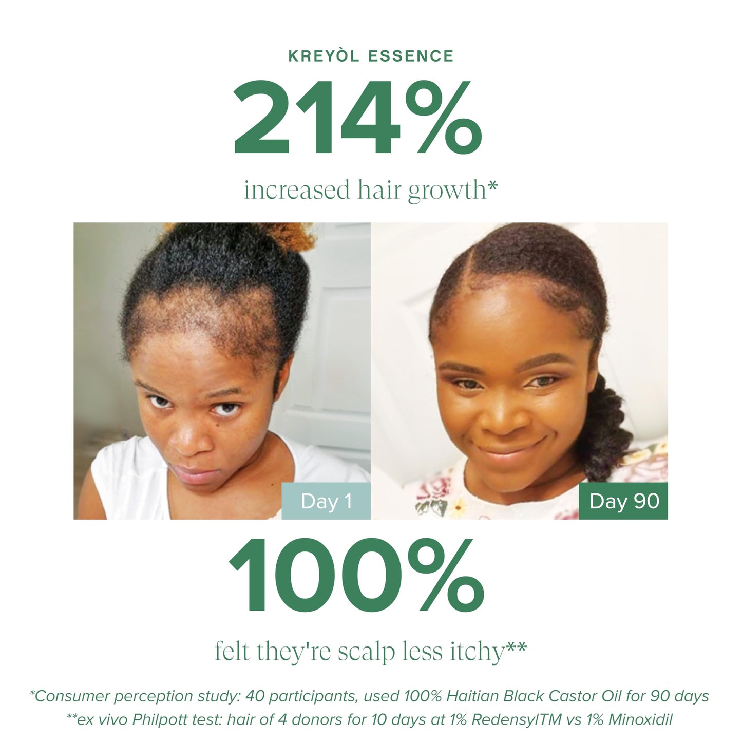 Kreyol Essence - Save Our Scalp Serum (S.O.S Serum) - Redensyl + Haitian Black Castor oil, Fuller Looking Hair, Cold Pressed Castor Oil, Natural Ingredients 1.7 oz