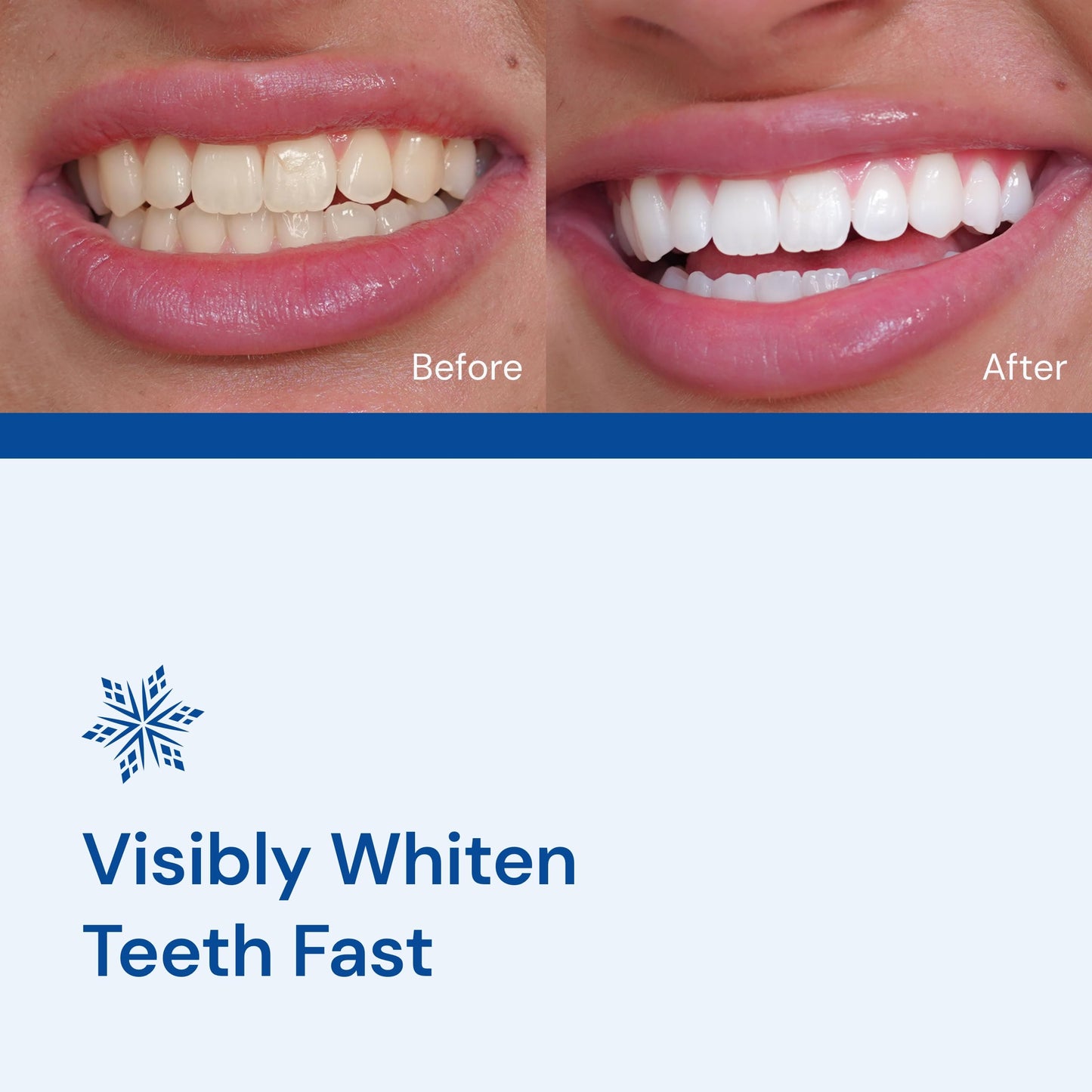 SNOW Diamond Teeth Whitening Strips | Gentle & Enamel Safe White Strips for Teeth Whitening | at-Home Dental Hygiene & Tooth Care for a White Smile Easy Convenient Tooth 42 Ct