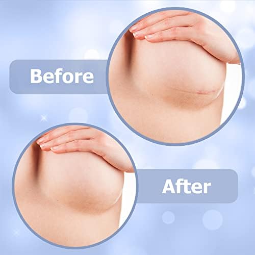 Breast Augmentation Recovery Supplies - Silicone Sheets for Healing - Comfortable Under Post-Op Bra (4 Pcs) - Great for Mom