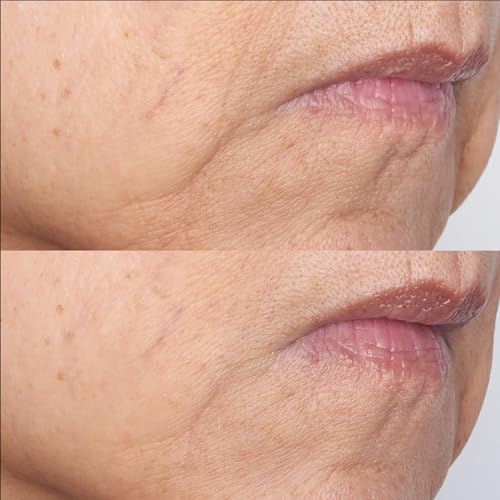 Perricone MD Cold Plasma Plus+ The Intensive Gel Mask, 2 fl. oz.