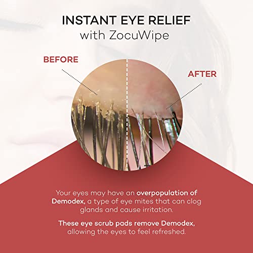 Zocuwipe Eyelid Wipes with Natural Okra Complex - Eyelid Cleanser and Moisturizer Pads for Irritated, Red Eyes from Dry Eye, Blepharitis 30ct
