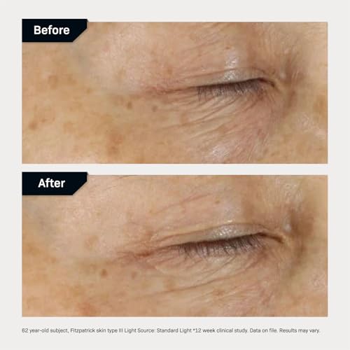 Revision Skincare D·E·J Eye Cream®, Firming and Moisturizing Treatment for Fine Lines, Wrinkles and Crow’s Feet, 0.25 fl oz