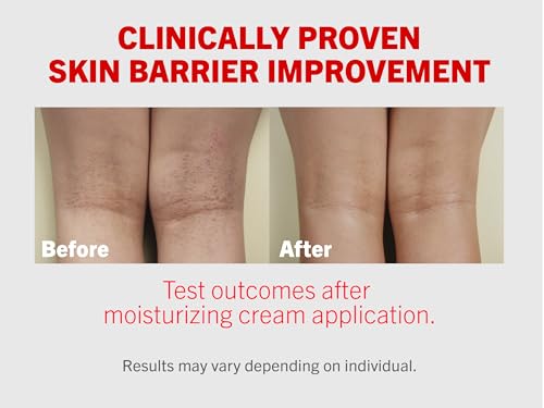 ATOPALM | Intensive Moisturizing Cream | Face & Body Moisturizer | For Dry & Sensitive Skin | Paraben-Free Lotion | Replenishes Hydration | Skin Barrier Repair | Korean Skin Care | 3.4 fl oz (100ml)