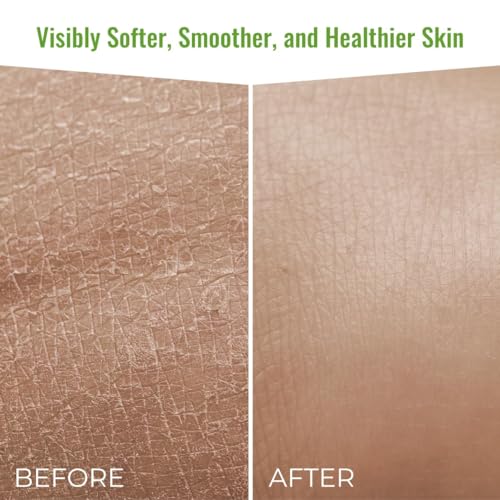 Wild Naturals Organic Body Wash – Moisturizing & Exfoliating Wash for Sensitive, Dry, Itchy Skin – Hydrating Hypoallergenic Body Wash for Men & Women