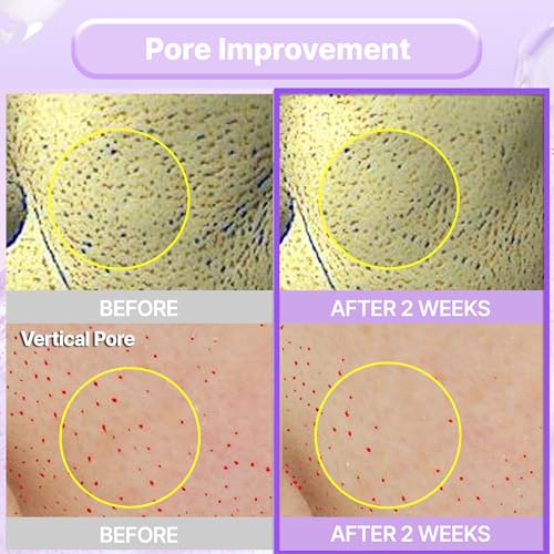BIOHEAL BOH Probioderm™ Collagen Remodeling Cream 1.69 fl oz (50 ml) | Pore Tightening Cream with 150,000 Collagen Capsules for Firmness & Smooth Texture | Lightweight Moisturizer for Flawless Skin