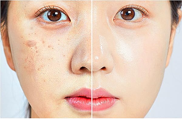 WHITESILK K-Beauty Anti-Aging & Repair Ampoule Serum | 85% Human Stem Cell & 10% PDRN for Visible Results (12 Vials, 120ml)