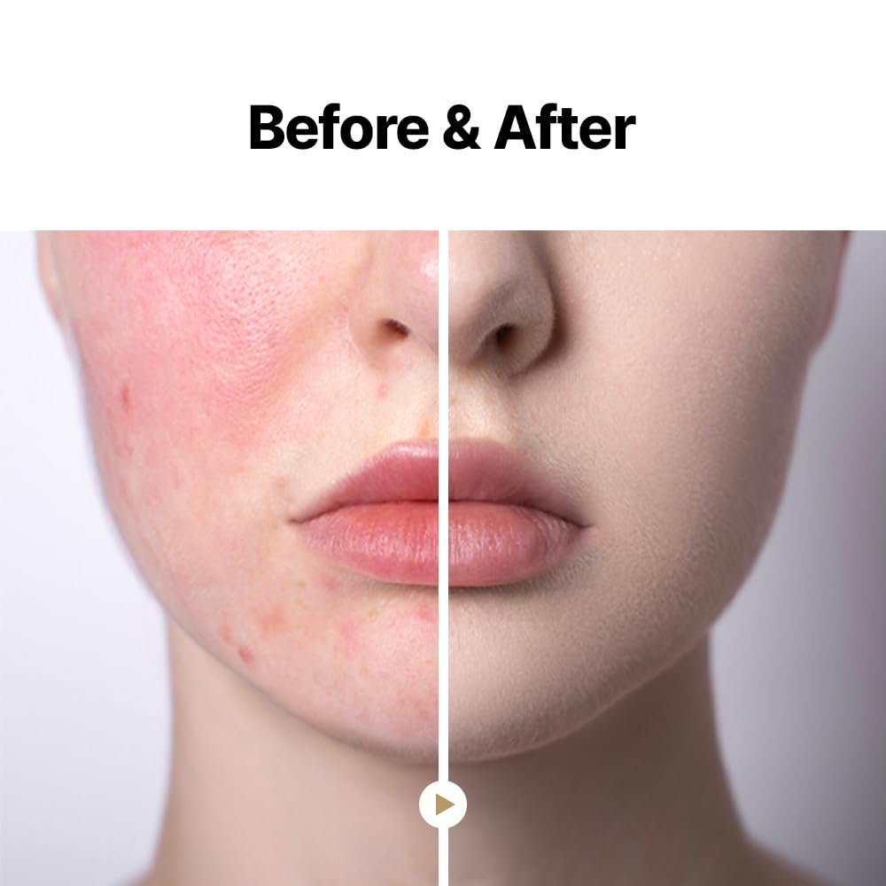 May COOP Moisture Essence Toner for Anti-Aging Korean Skincare 150mL – Hydrating Skin with Wildcrafted Centella Asiatica, Rice Water & Birch Bark – Nourishing – Fast-Absorbing