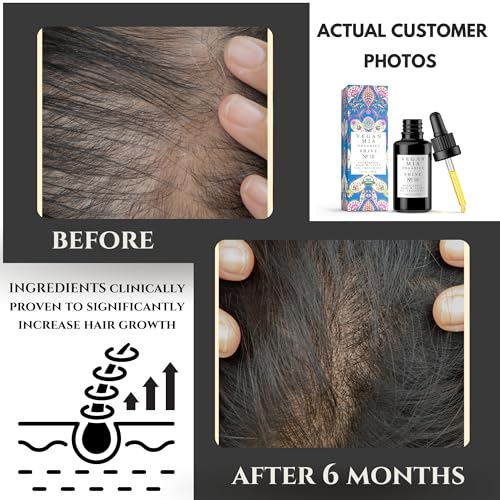 Vegan Mia USDA Organic Rosemary Oil for Hair Growth with Castor Oil & More - Scalp Oil Treatment & Intense Nourishment to Get Healthier, Thicker & Shiny Hair Naturally, 1 fl oz Bottle