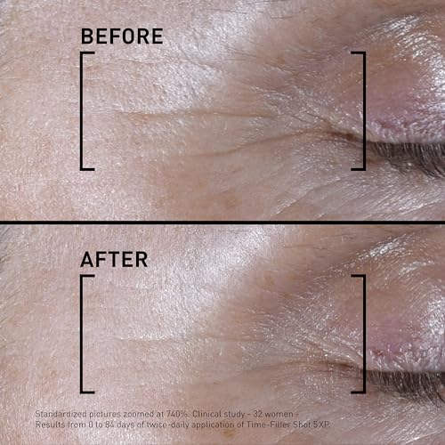 Filorga Time-Filler Shot, A Moisturizing Serum with Neuropeptide Technology & Polysaccharides to Relax Expression Lines, Hydrate, & Firm Skin for Visible Results in 7 Days, 0.5 fl. Oz.