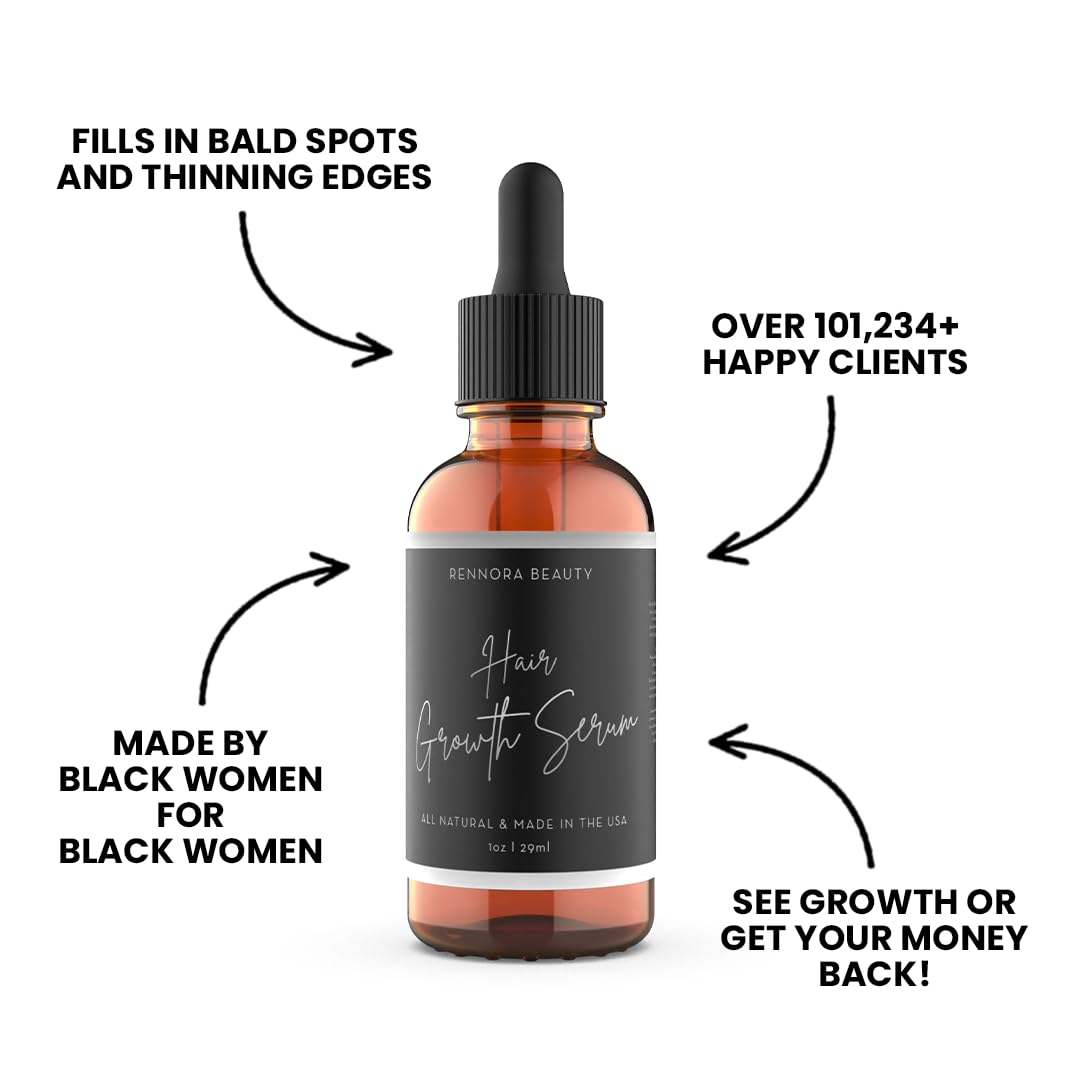 Rennora Hair Growth Serum with Organic Herbs and Natural Vitamins, Peppermint Oil, Stinging Nettle, and Rosemary Oil, No Chemicals, Formulated for Hair Regrowth (1oz per bottle, 4 Pack)