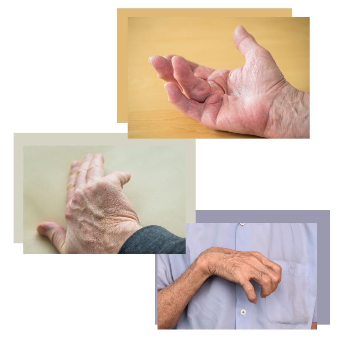 Restorative Medical BendEase Hand Splint - Wrist Pain Support for Carpal Tunnel, Arthritis and Stroke Recovery (Medium - Right)