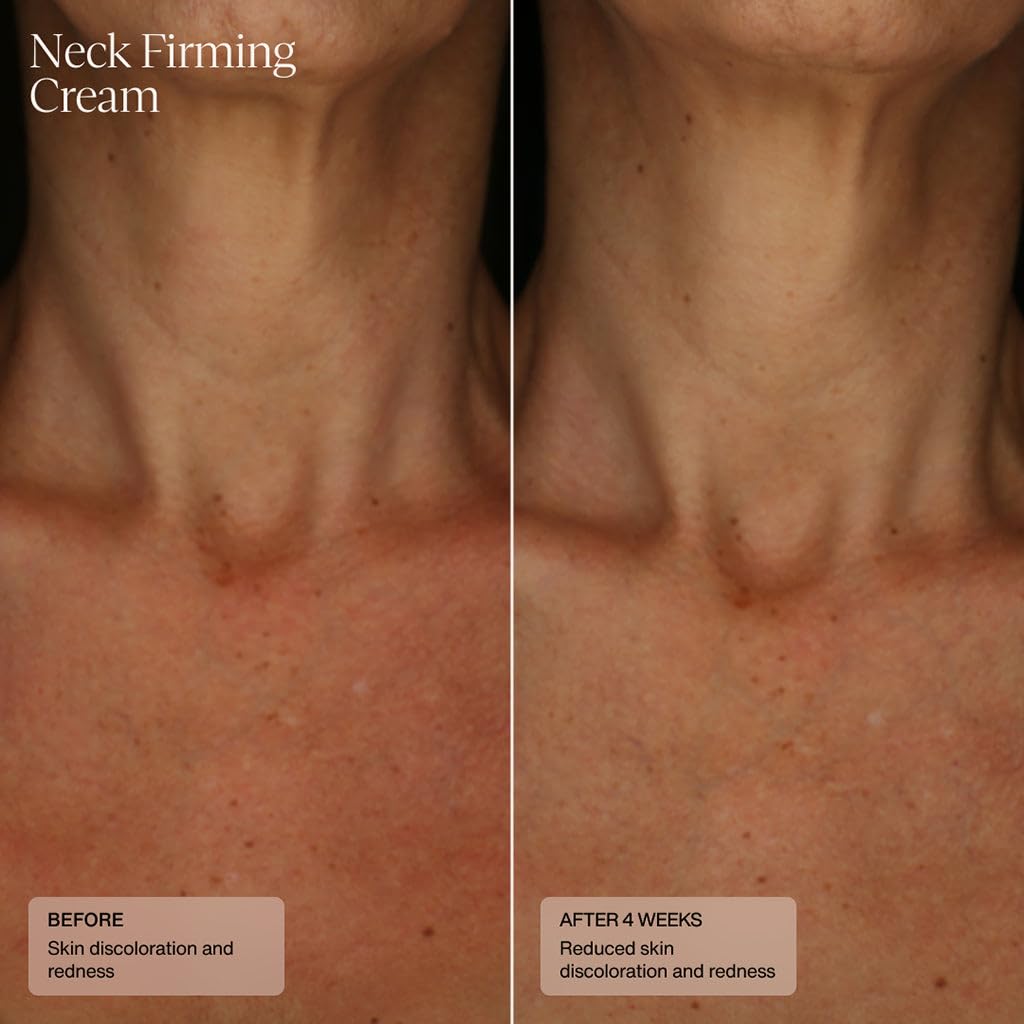 Sente Neck Firming Cream - Advanced Anti-Aging Firming and Lift Cream with Patented HSA, Caffeine and Vitamin C - 1.7 Oz