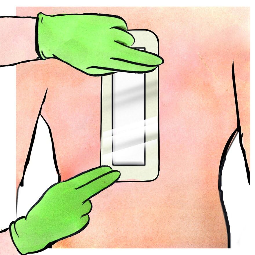 Medline Stratasorb Composite Composite Adhesive Island Wound Dressings, 4" x 14" (Pack of 10)