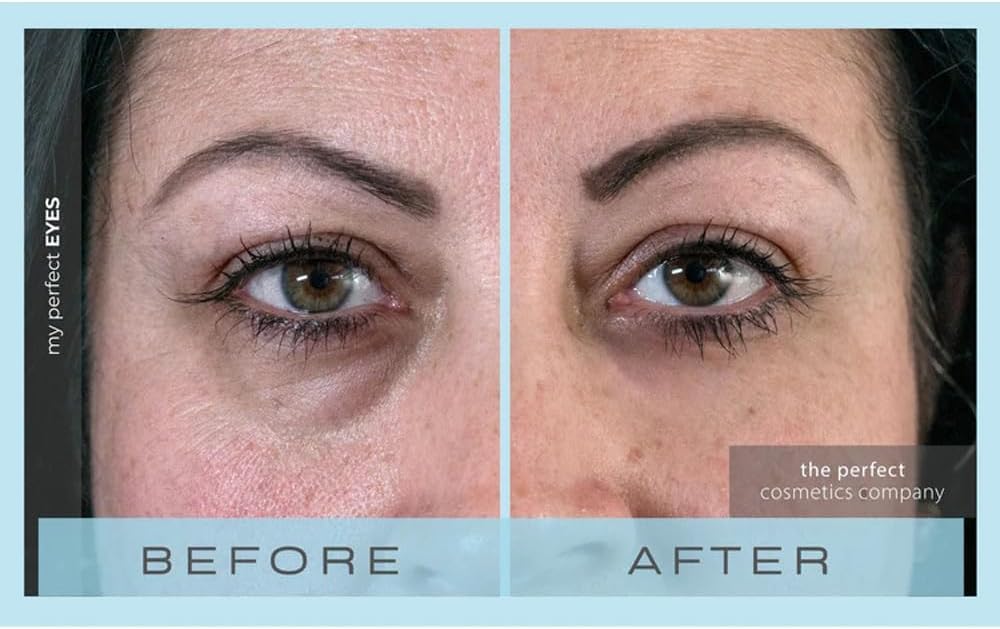 My Perfect Eyes by Penny Lane | Anti-Aging Eye Cream for Dark Circles & Puffiness | Instant Firming Treatment for Wrinkles & Fine Lines | Undereye Serum to Reduce Bags & Hollows | 20ml
