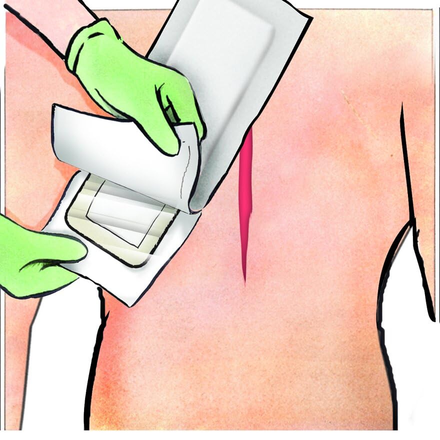 Medline Stratasorb Composite Composite Adhesive Island Wound Dressings, 4" x 14" (Pack of 10)