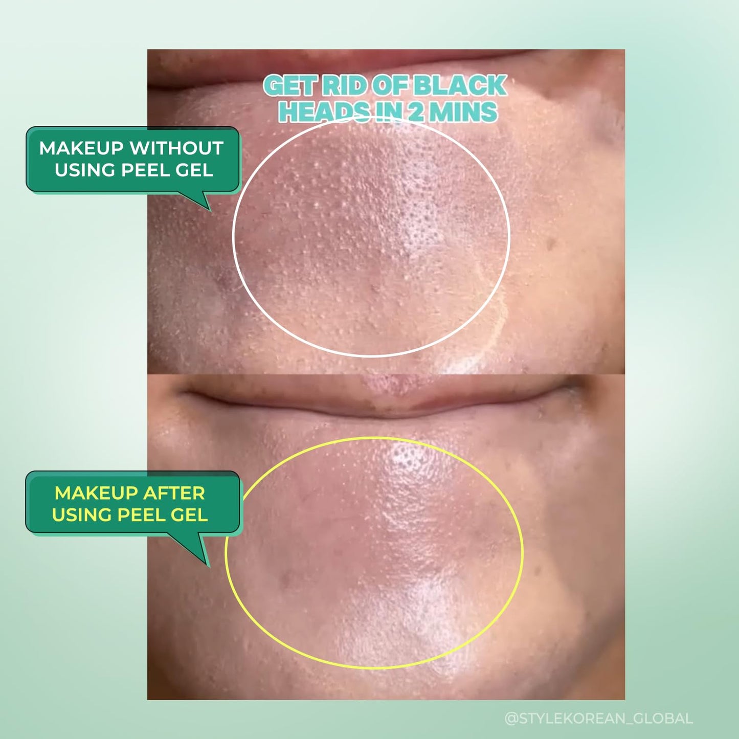 MOTHER MADE Exfoliating Vegan Facial Peeling Solution with Green Tea, Vitamin E, Hyaluronic Acid (Pack of 2) | Gentle Natural Face & Full Body Scrub Exfoliator, Cleansing, Peeling, Korean Skincare