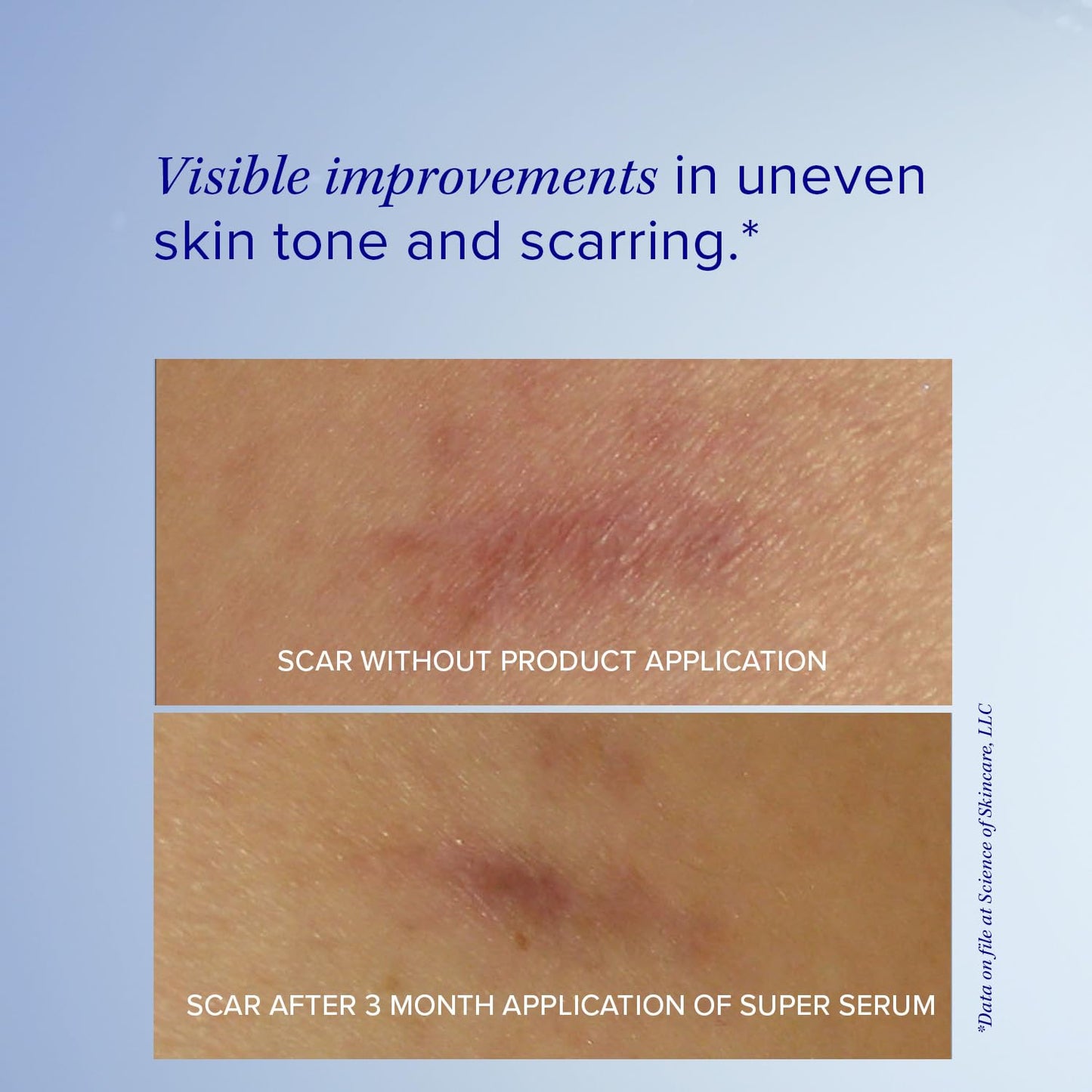 iS CLINICAL Super Serum Advance+, Anti-Aging Vitamin C Face Serum, reduces scaring and fine stretch marks, 0.5 Fl Oz