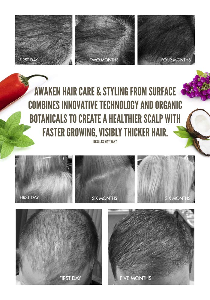 SURFACE Hair Awaken Therapeutic Masque, Scalp And Hair Rejuvenating Mask for Thinning Hair, 6 Oz.