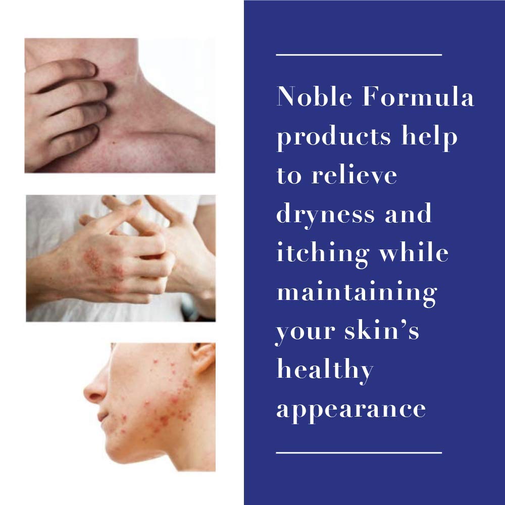 Noble Formula 1% Hydrocortisone Cream with .25% Pyrithione Zinc (Znp), 4 oz