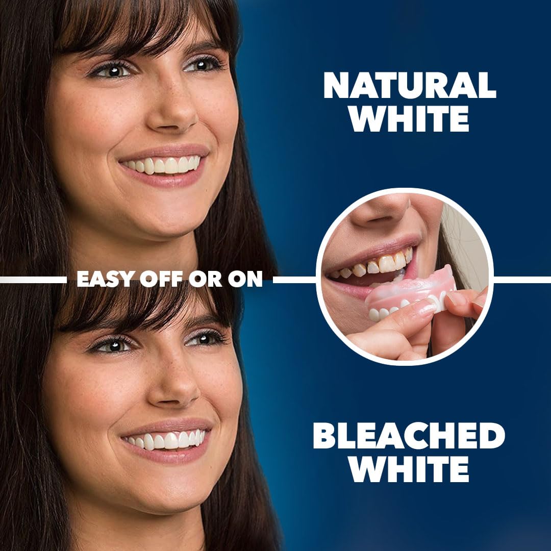 Imako Premium Cosmetic Uppers - 2 Pack - Small, Natural White - DIY Smile Makeover - Made in USA