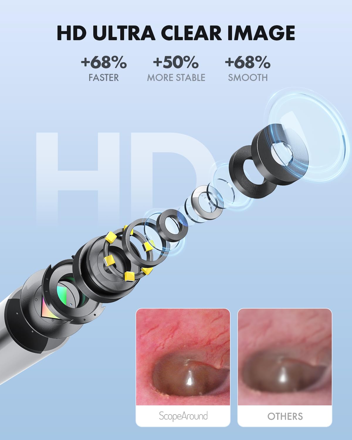 ScopeAround Otoscope with Light, Ear Camera with Dual View, 720pHD WiFi Ear Scope with 6 LED Lights, 3.9mm Lens Otoscope Camera for Kids and Adults, Ear Scope Compatible w/Android and iPhone