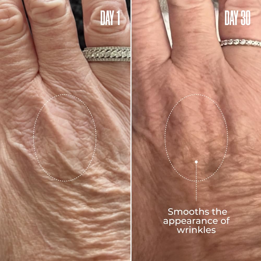 MAËLYS B-GLOSSY Smoothing Body Serum - Anti-Aging Hyaluronic Acid Serum for Body Wrinkles - Hydrating Wrinkle Serum with Peptides & Shea Butter To Smooth The Appearance Of Wrinkles