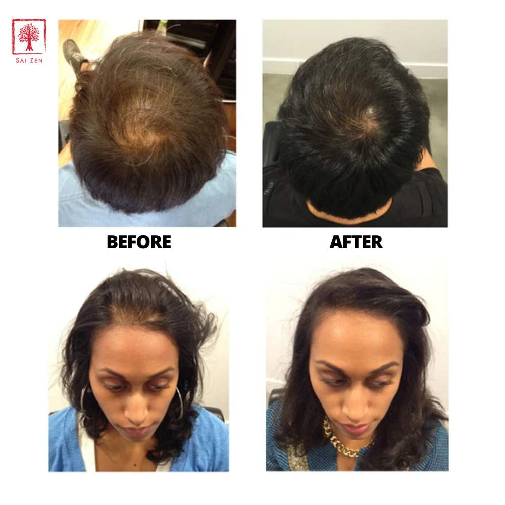 Sai Zen Anti-Aging Volume Shampoo | Anti-Thinning and Volumizing Formula | Made in USA | Sulfate and Paraben Free | All Hair Types, 8 oz.