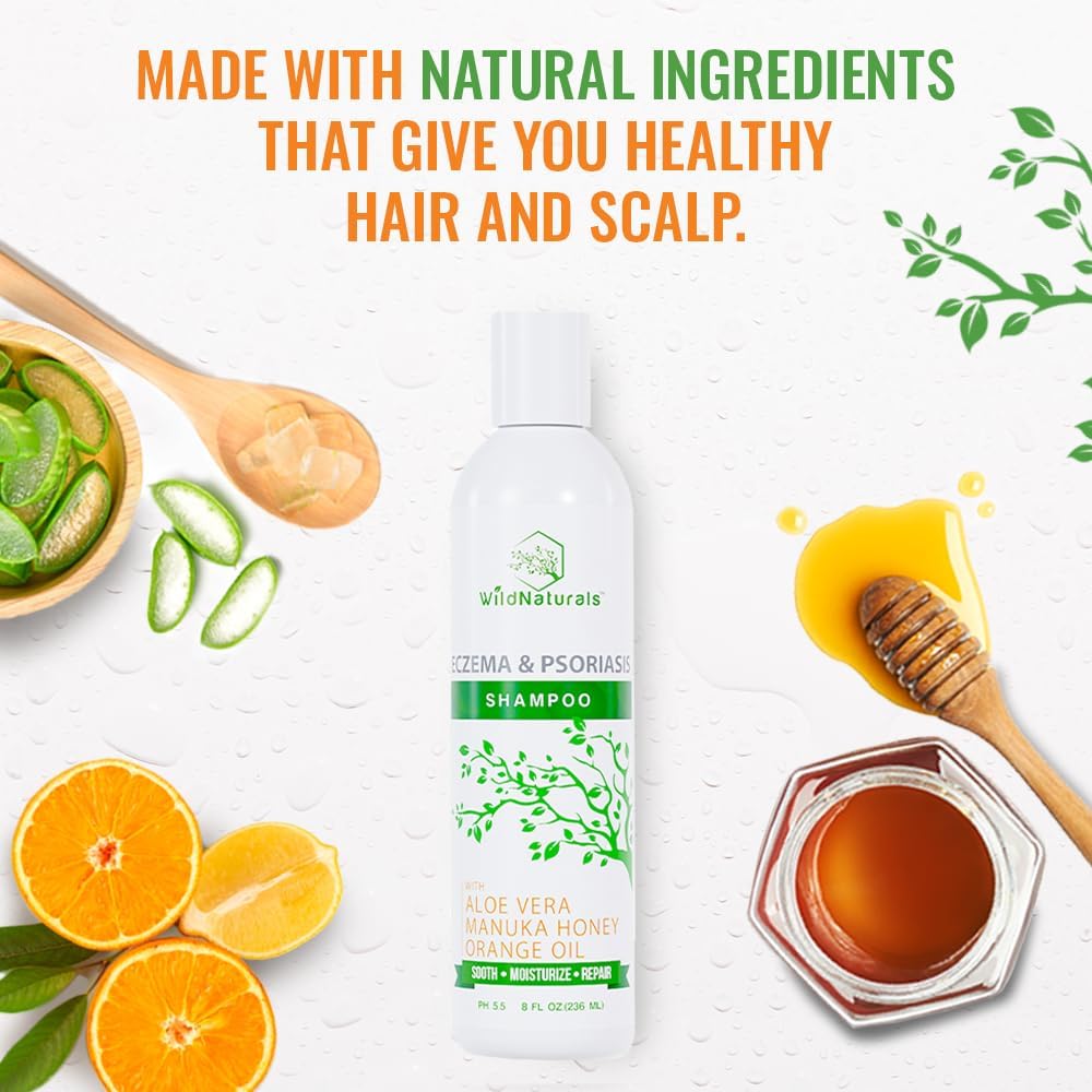 Eczema and Psoriasis Deep Conditioning Treatment - Anti-Dandruff Conditioner for Damaged, Dry Hair and Scalp - Seborrheic Dermatitis Relief