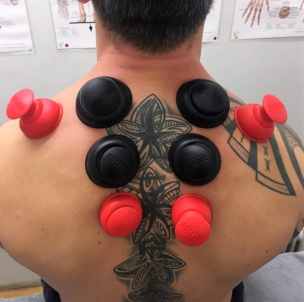 RockTape RockPods 2-Piece Cupping Set with Carrying Case