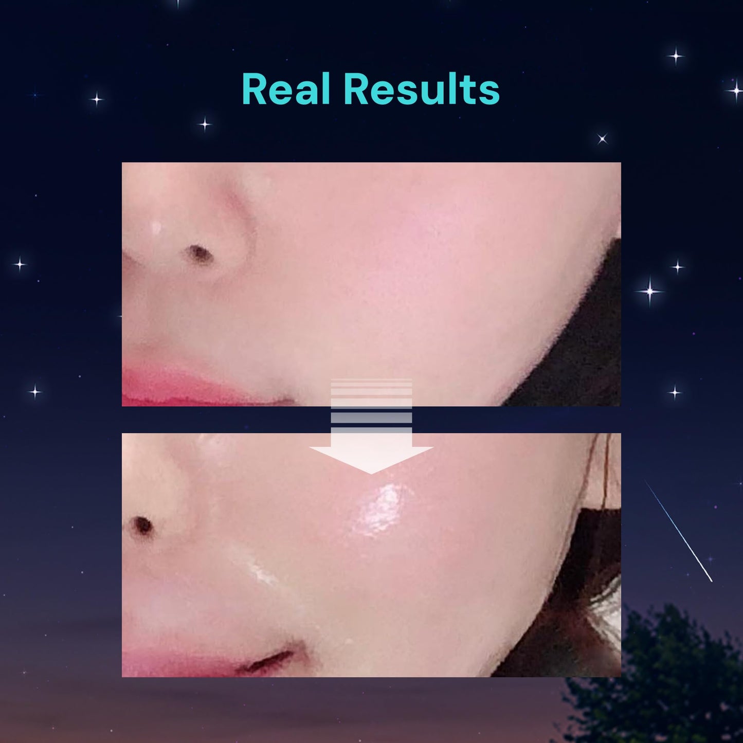 THANKYOU FARMER Saccharomy Brightening Star Mask (10ea) - Phyto Mucin Essence for Glowing, Niacinamide, Fermented Rice, Saccharomyces, Korean Sheet Mask for Dry and Dehydrated Skin (10)
