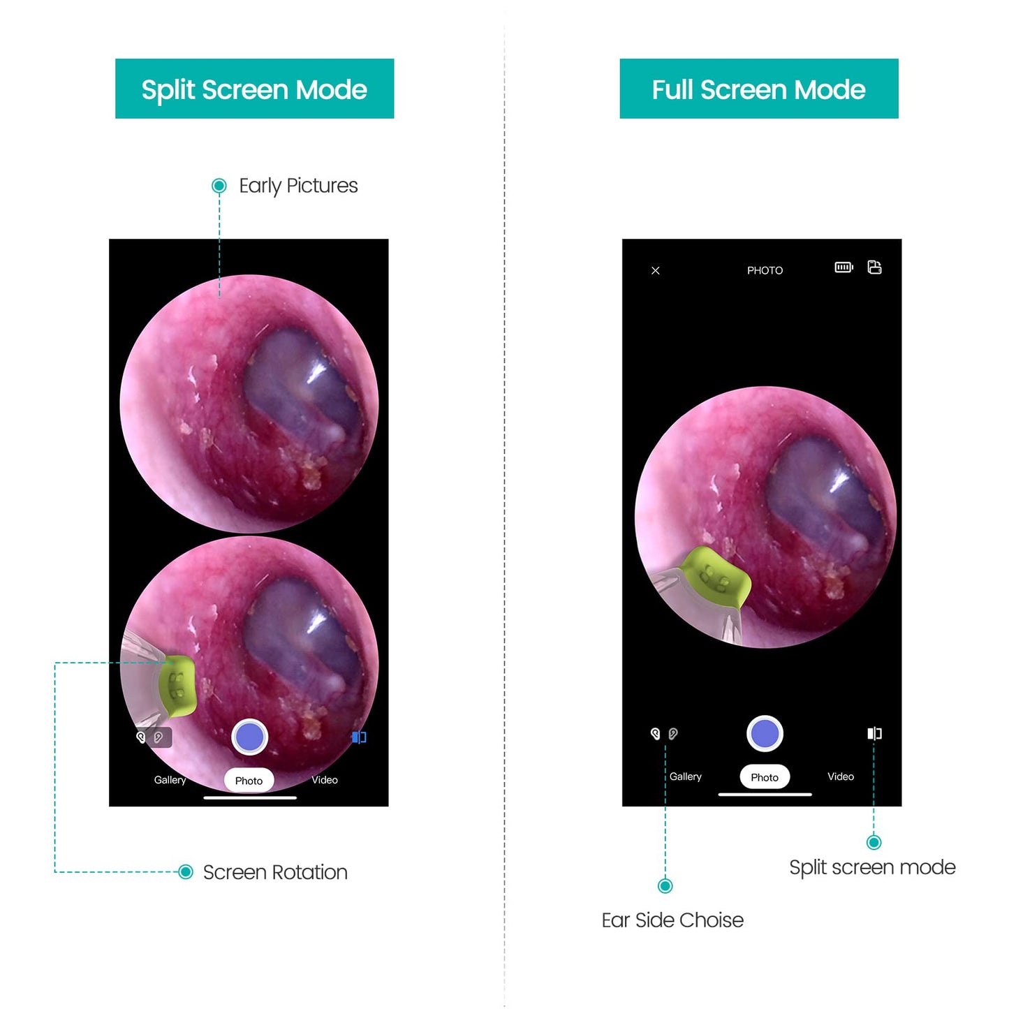 ScopeAround Otoscope with Light, Ear Camera with Dual View, 720pHD WiFi Ear Scope with 6 LED Lights, 3.9mm Lens Otoscope Camera for Kids and Adults, Ear Scope Compatible w/Android and iPhone
