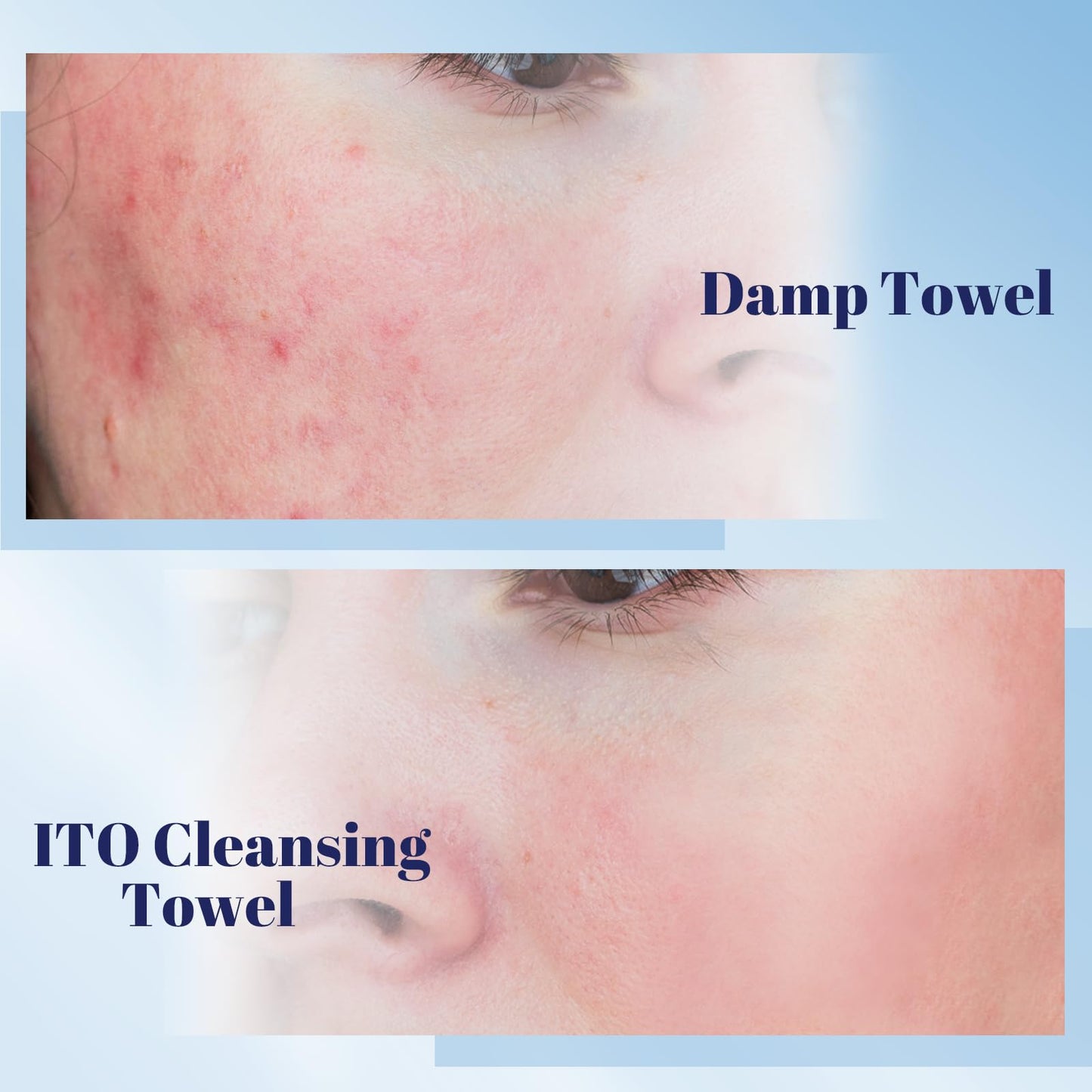 ITO Disposable Face Towel, 70 Count Ultra-Soft 1-Second Quick-Dry Face Towels, Gentle for Sensitive Dry Oily Skin, Facial Tissue for Daily Cleansing Makeup Removal (Pack of 3)