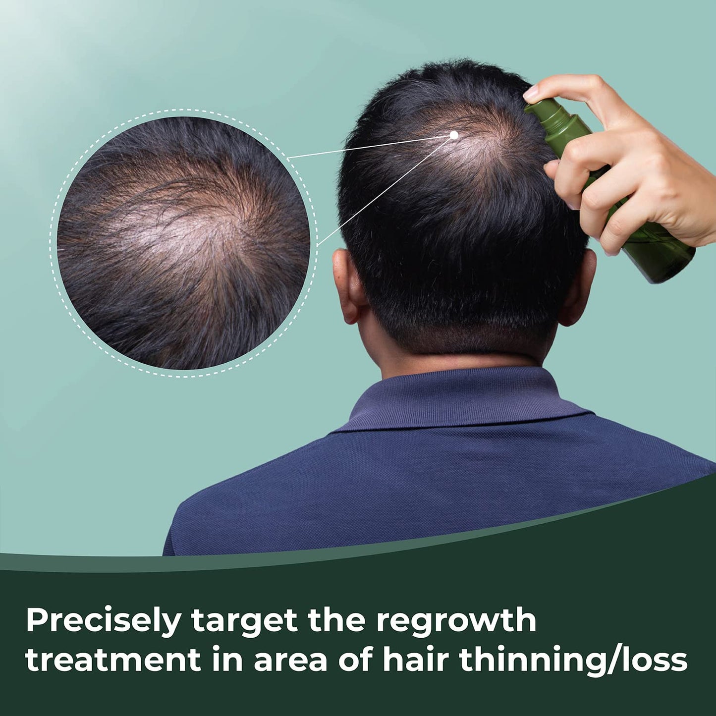 Thik&Fix Hair Growth Spray, Hair Thickening Spray for Men & Women, Increase Volume & Texture, Moisturizing Scalp and Hair, Reduce Tangles (3.38 Fl oz)