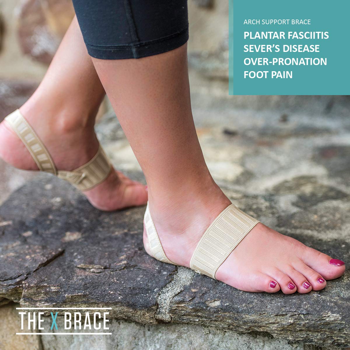 Tuli's X Brace, Arch Support Brace and Compression for Sever's Disease, Plantar Fasciitis, Heel Pain, Flat Feet, Fallen Arches and Over-Pronation, 1 Pair, X-Small