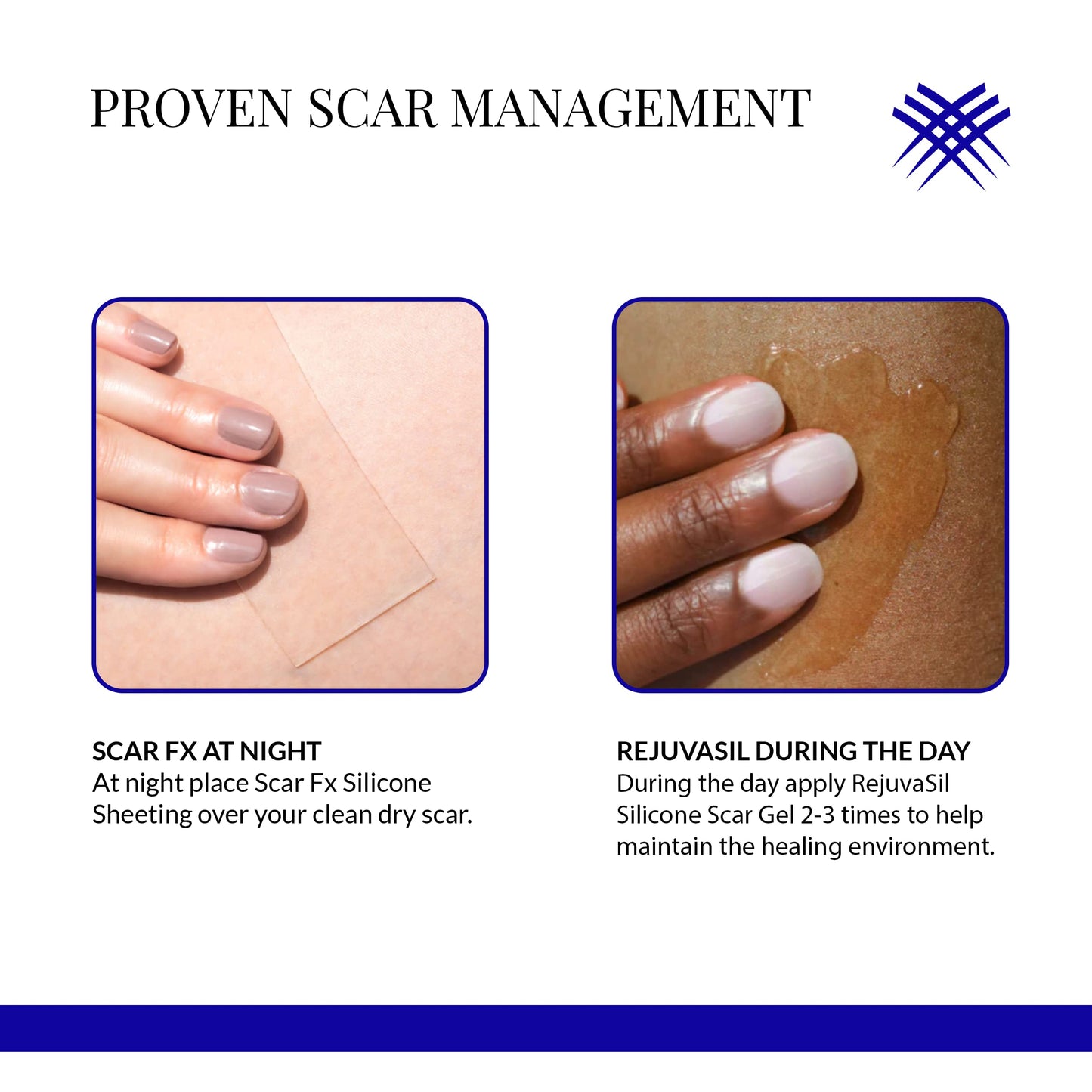 Rejuvaskin Scar Fx Silicone Sheeting, 1 Inch x 12 Inches Silicone Tape for Long Surgical Scars, 1 Sheet, Soften, Flatten & Reduce The Appearance of Scars