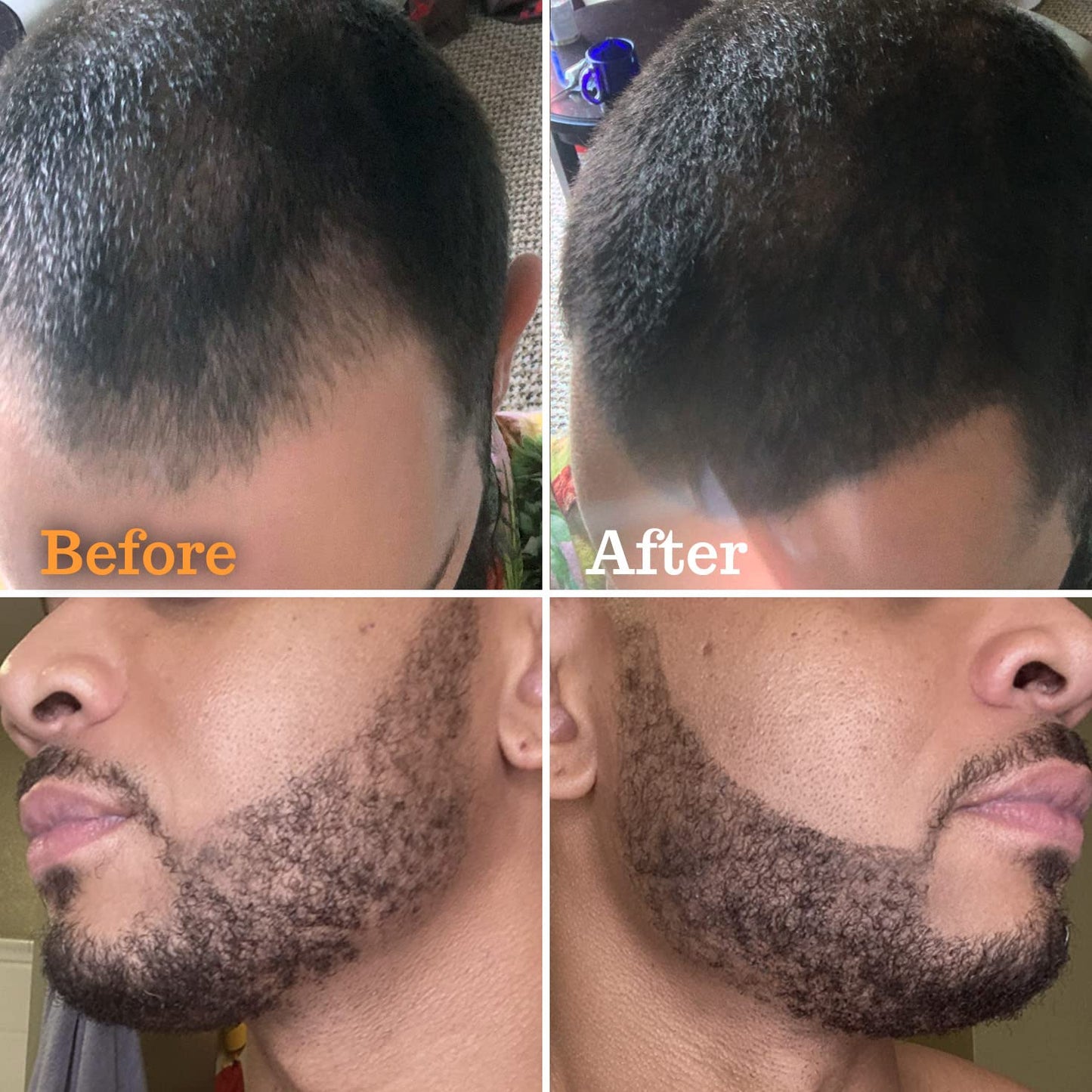 Beard Pen Filler for Men - Barber Styling Grooming Pencil - Waterproof, Sweat Proof, Long Lasting Solution with Natural Finish - Cover Beard and Scalp Patches in Seconds - Black 5 Pack