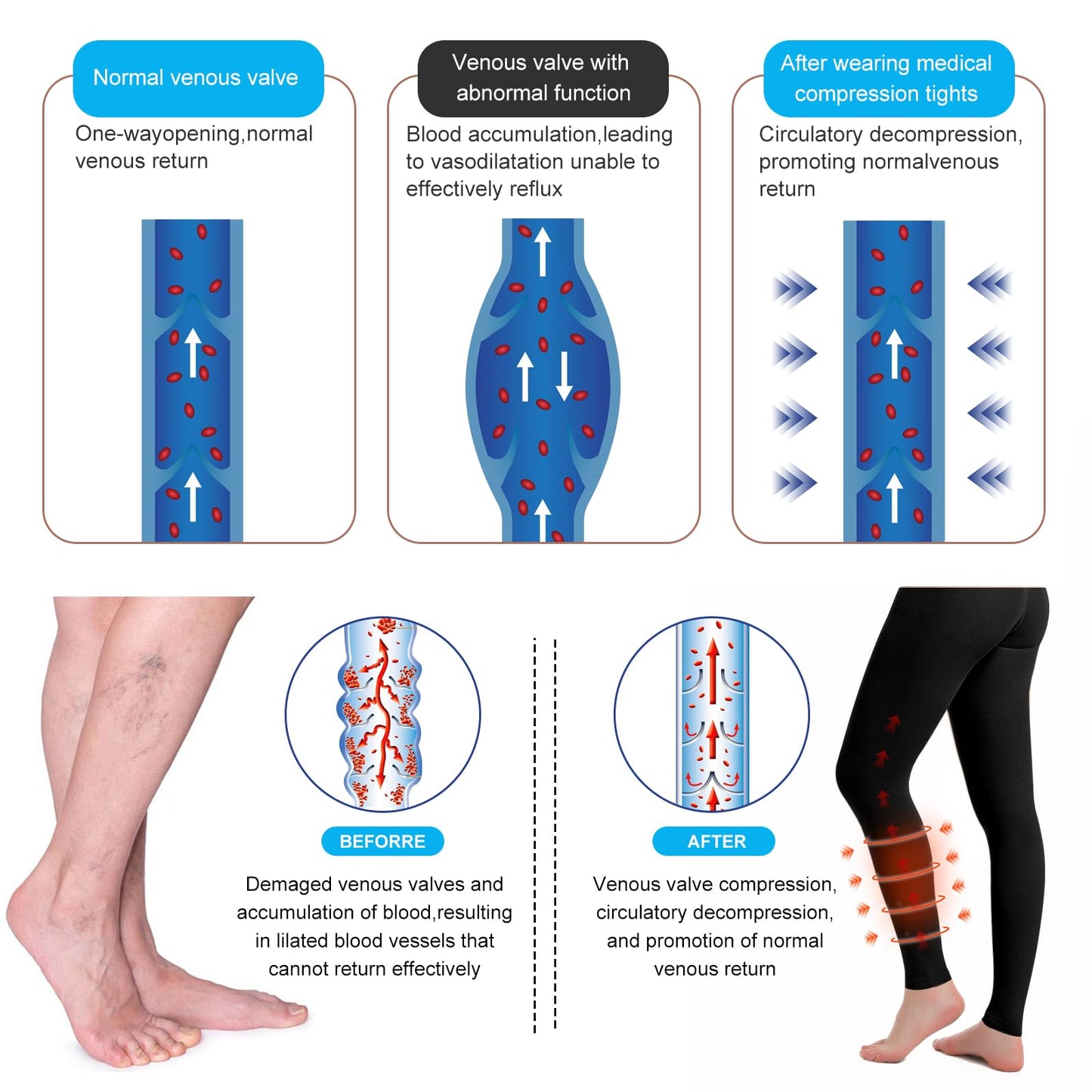 2 Pairs Medical Compression Pantyhose for Men & Women, 20-30mmhg Gradient Support Tights pants, Open Toe High Waist Tights, Graduated Tights for Varicose Veins, Edema, Deep, Thrombosis , During(M)