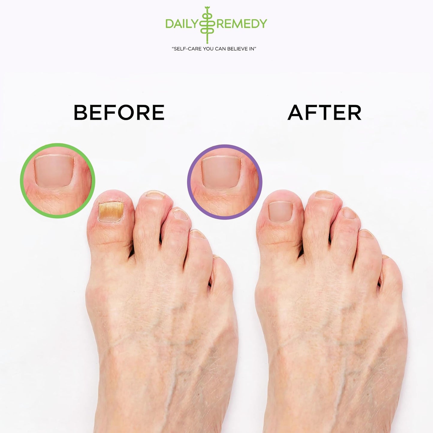 DAILY REMEDY 4-Pack - 2 Extra Strength Tea Tree Oil & 2 Calming Lavender Foot Soak Set - Made in USA - Soothes Sore Tired Feet, Athletes Foot, and Softens Calluses - 64 oz