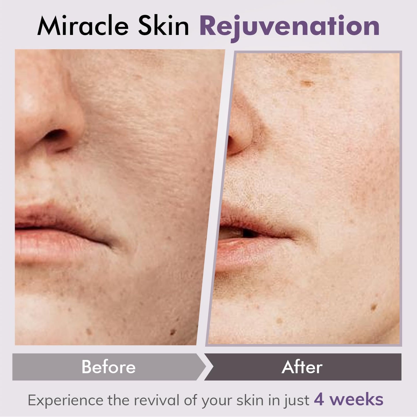DERMASOF Natural Retinol Serum for Face,Vitamin C Derived Face Serum,Hydroxypinacolone Retinoate Gentle,Non Irritating and Easily Absorbed,Smooth Fine Lines & Wrinkles Alleviate Redness;1 Fl Oz(30ml)