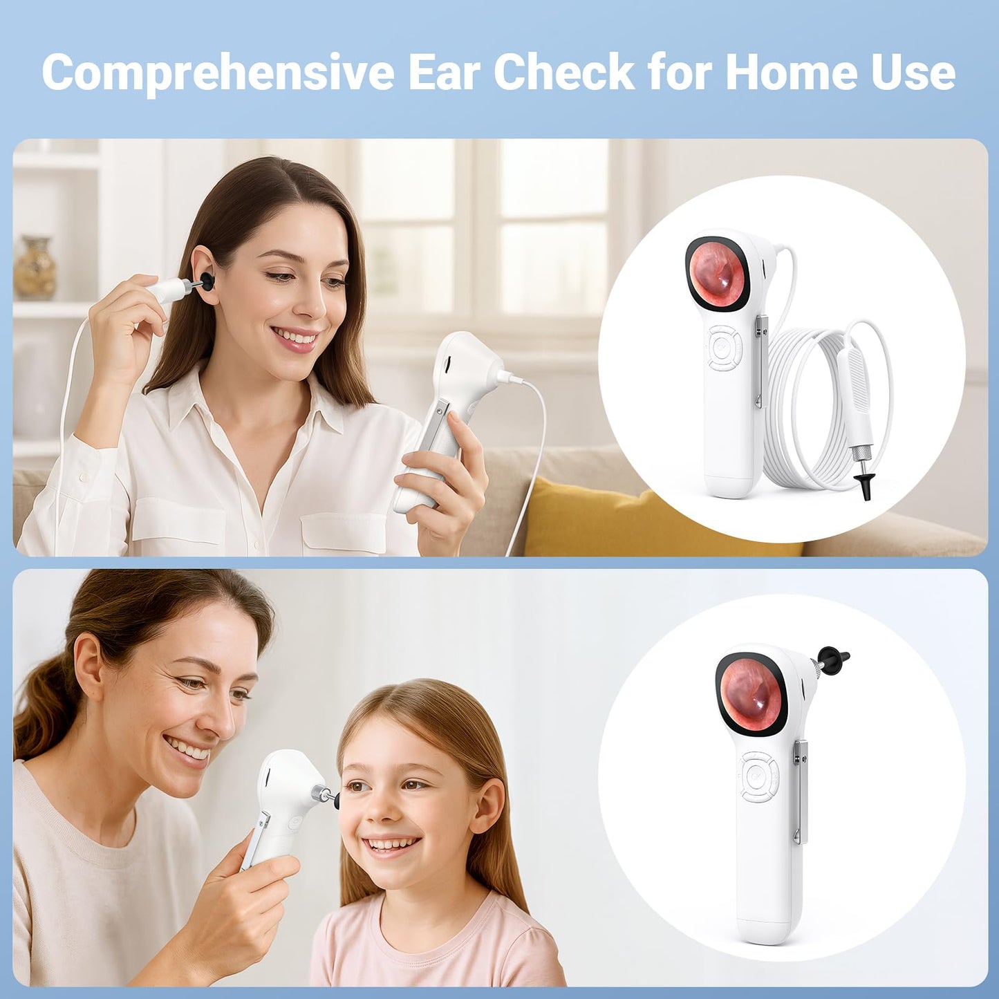ScopeAround Otoscope with Light, 720P HD Ear Cleaning Camera & 6 LED Lights Ear Scope, 1.45" IPS Display Digital Otoscope, Ear Scope with Extention Cable, Smart Ear Camera, Ready to Use White