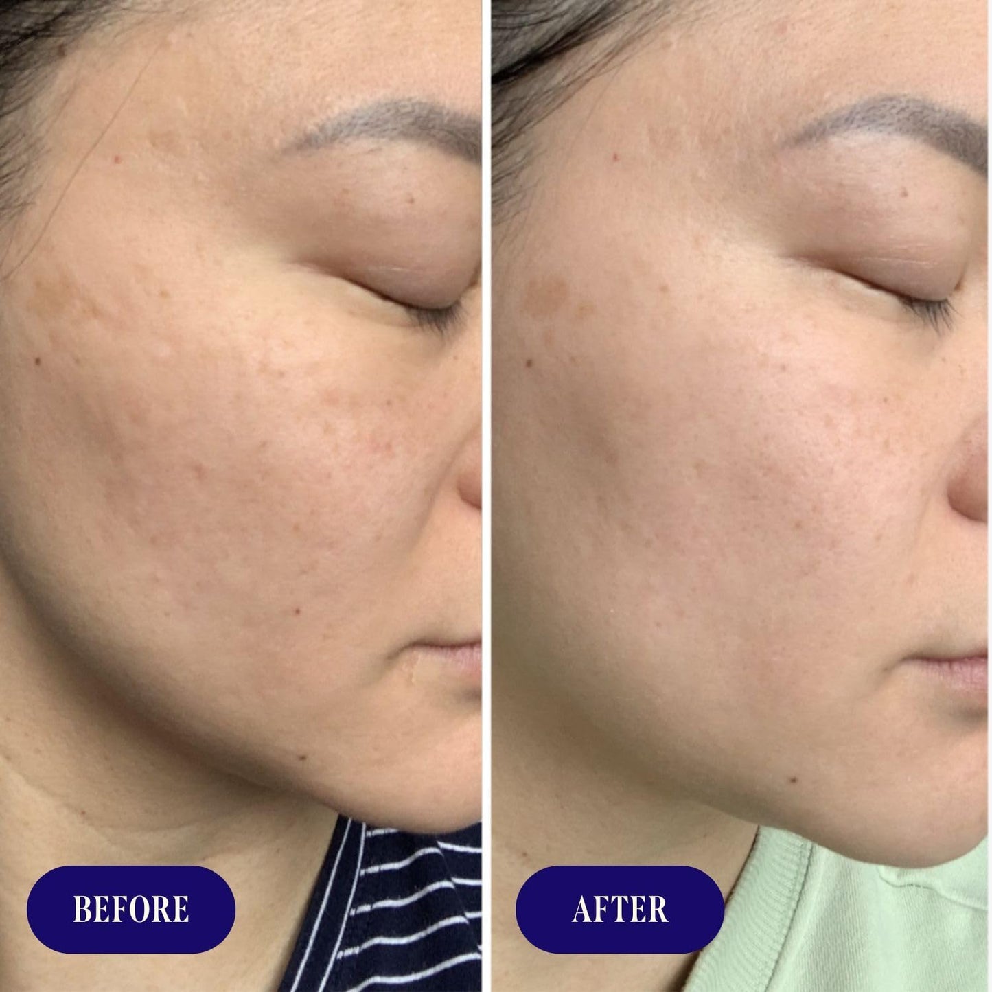 Three Ships Dew Drops Hyaluronic Acid And Vitamin C Serum - Vegan Facial Serum Brightens And Plumps Skin - Intensive Natural Face Serum for All Skin Types- As Seen on Dragon’s Den, 01 Fl Oz