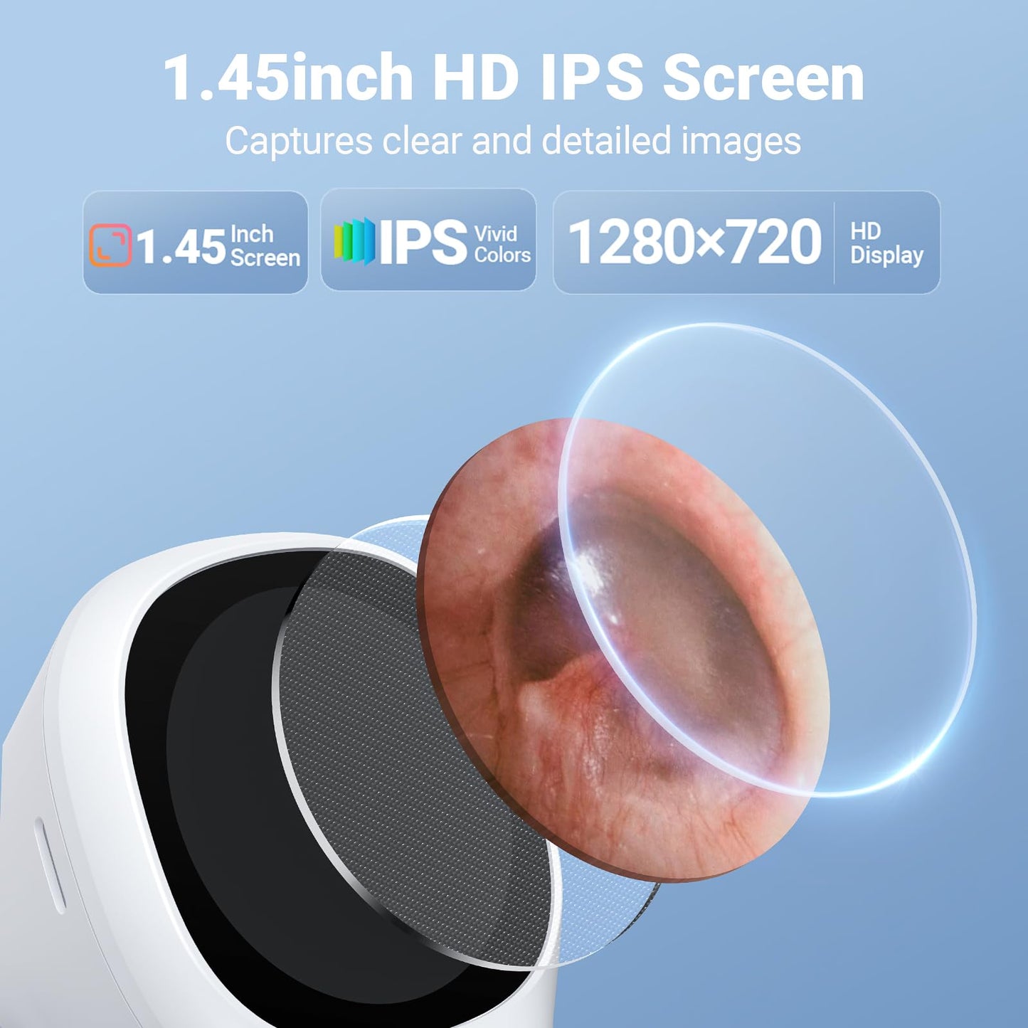 ScopeAround Otoscope with Light, 720P HD Ear Cleaning Camera & 6 LED Lights Ear Scope, 1.45" IPS Display Digital Otoscope, Ear Scope with Extention Cable, Smart Ear Camera, Ready to Use White