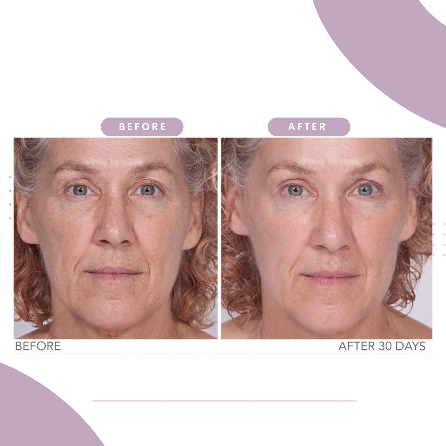 Serious Skincare Reverse Lift Firming Face Serum - Argifirm™ Lifting Complex - Temporarily Tighten - Lift – Firm - Sagging Facial Contours - Peptides - Seaweed and Botanical Extracts - 1.0 Fl. Oz.