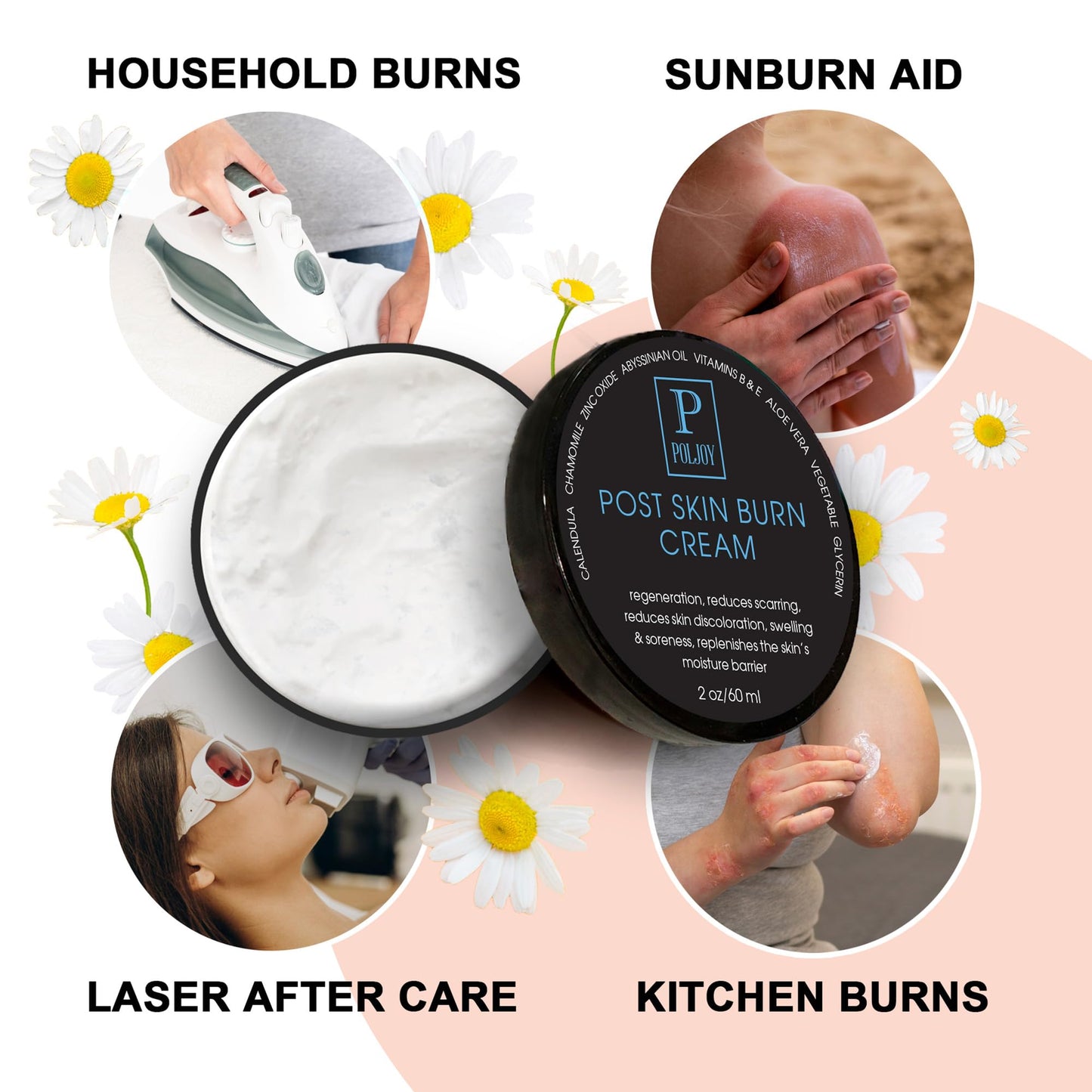 Skin Burn Cream Repair Natural - Post Burns Healing Remedy - Scar Care Promotes Recovery - Soothing First Degree Treatment - Sunburns Aid Fast Relief - Household & Vacation - Made in US (Pack of 2)