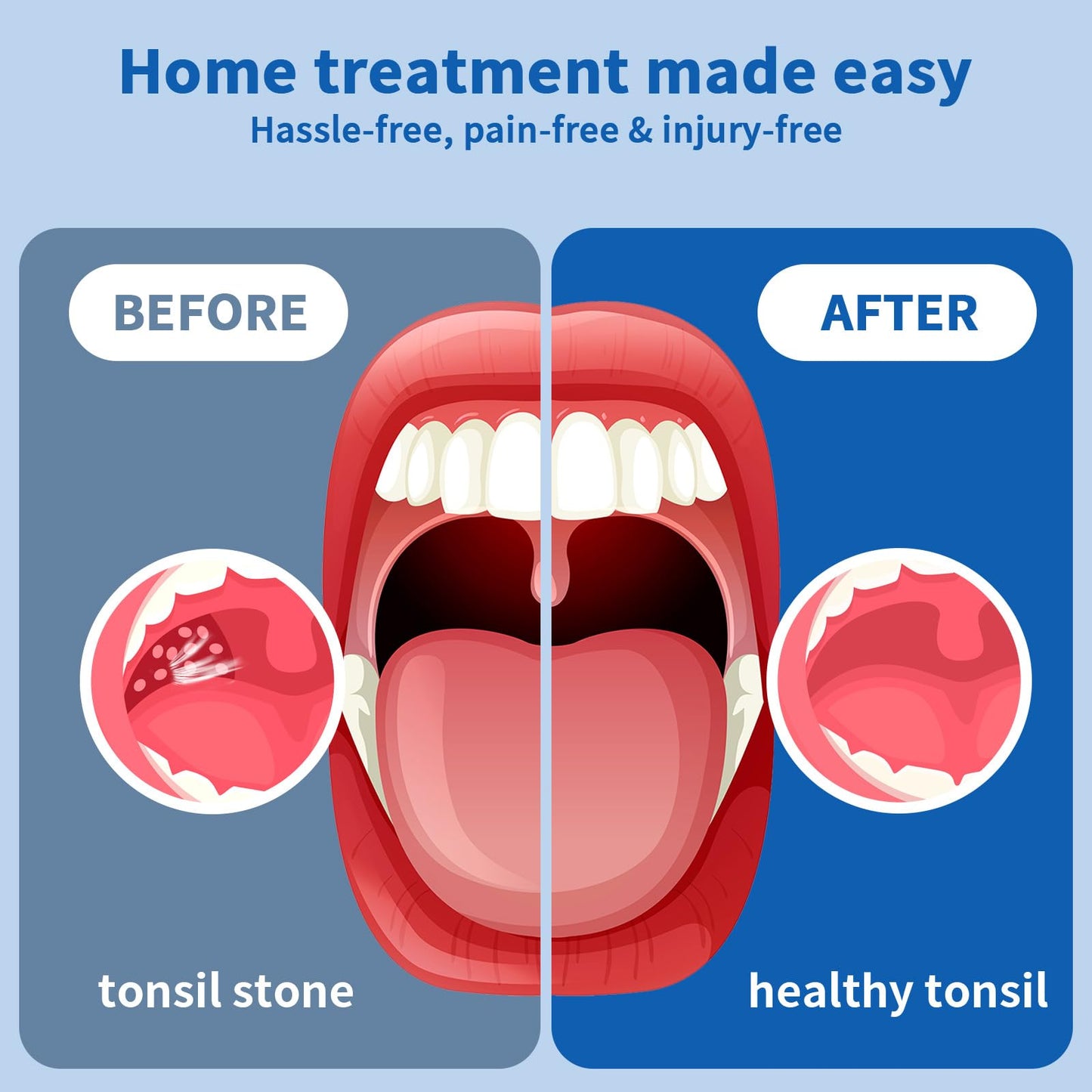 Sinkawa Electronic Tonsil Stone Remover Vacuum，10 in 1 Tonsil Stone Removal Kit，Tonsil Stone Remover Vacuum with Built-in Blue Light，Easy to Use, Fight Bad Breath, Mouth Cleaning Oral Care